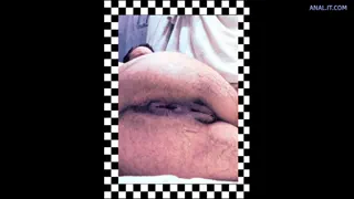 Preview at 00:11